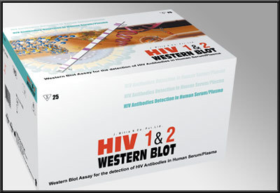 western blot test for hiv