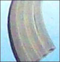 Orhopaedic Casting Tape